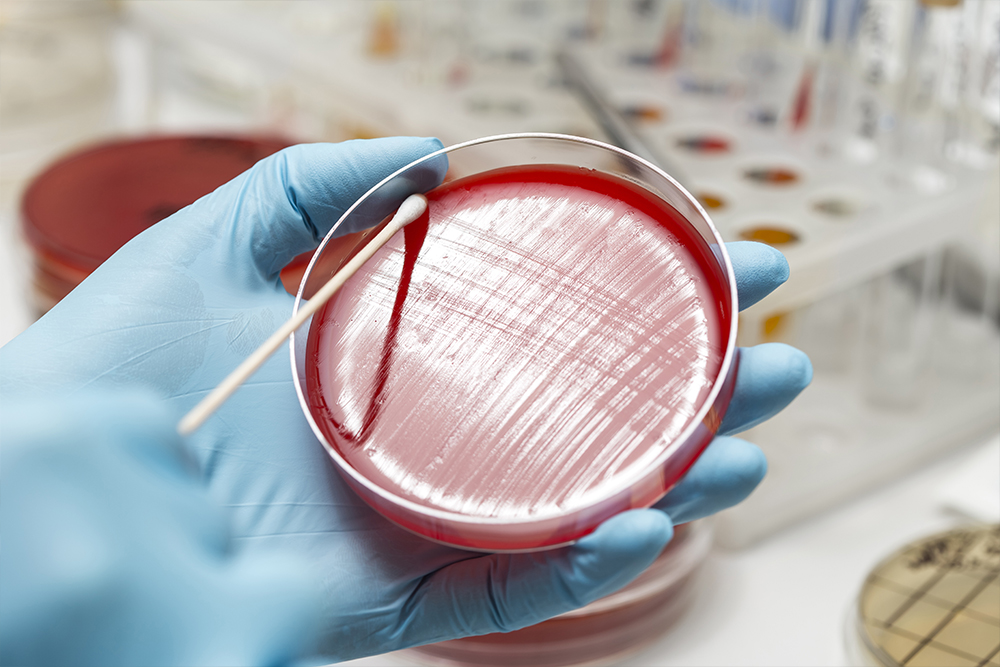 Beneficii pentru sănătate ale agar agar-ului